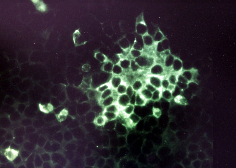 Illustration for article titled Psychedelic Images of Terrifying Viruses